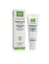 MARTIDERM ACNIOVER CREMIGEL ACTIVO (Active cremigel) - 40 ml NEW VERSION